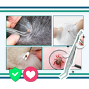 Pince à Tiques De Précision